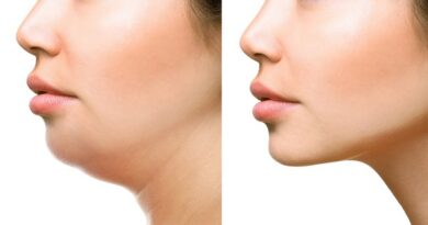 Facial Liposuction