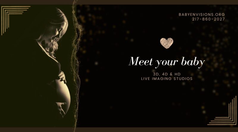 12 Week Ultrasound