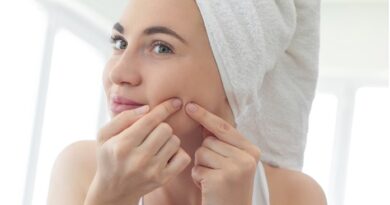 Treating Acne